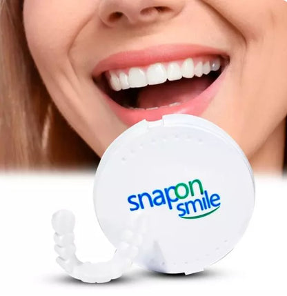Carillas Dentales Snap-On Smile – Sonrisa Perfecta al Instante