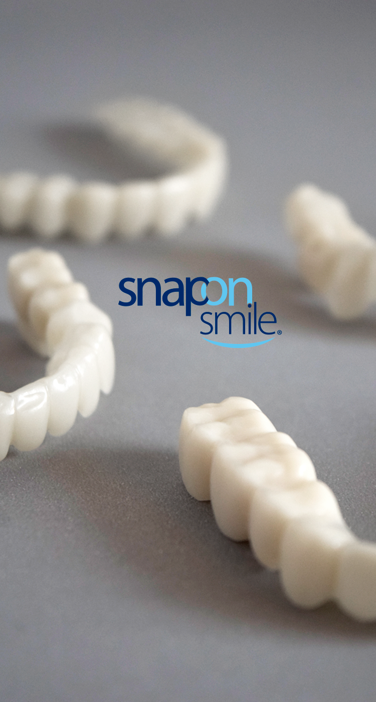 Carillas Dentales Snap-On Smile – Sonrisa Perfecta al Instante